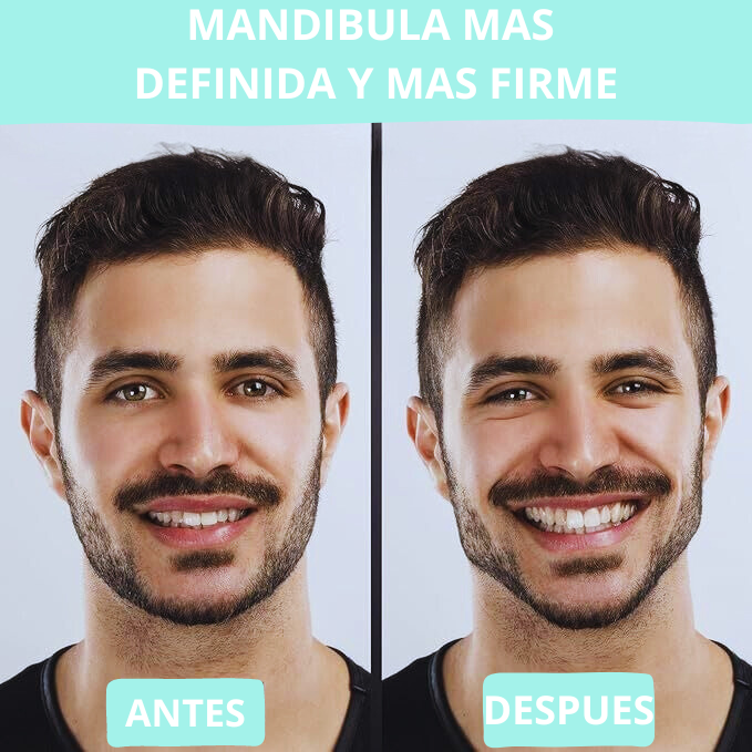 Ejercitador de mandibula belnieme pro